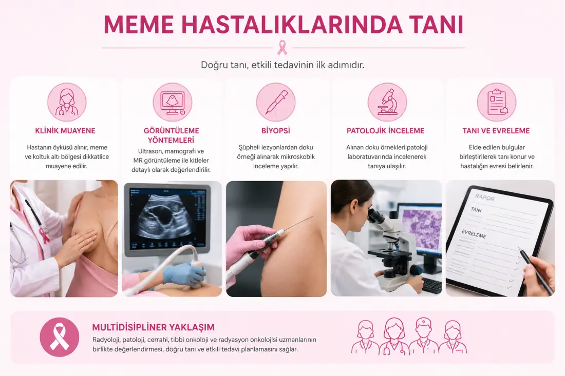 Meme Hastalıklarında Tanı