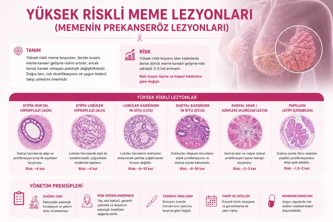 Yüksek Riskli Meme Lezyonları