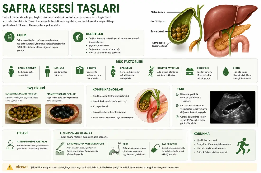 Safra Kesesi Taşları